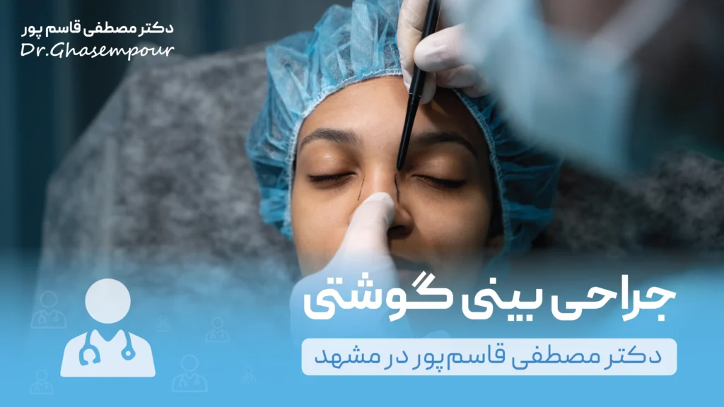 جراحی بینی گوشتی